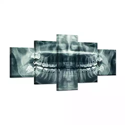 Modern Home Canvas Art X-Ray Dental Tooth